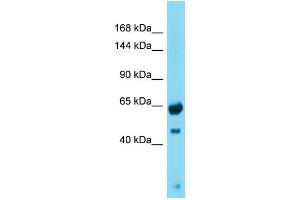 Western Blotting (WB) image for anti-Growth Regulation By Estrogen in Breast Cancer 1 (GREB1) (N-Term) antibody (ABIN2774550)