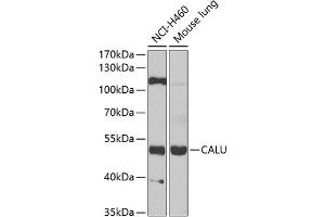 Western blot analysis of extracts of various cell lines, using CALU antibody (ABIN6129533, ABIN6137878, ABIN6137880 and ABIN6222201) at 1:1000 dilution. (CALU antibody  (AA 20-315))