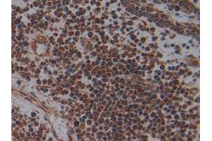 Immunohistochemistry (IHC) image for anti-Placental Alkaline Phosphatase (ALPP) (AA 162-312) antibody (ABIN7432097)