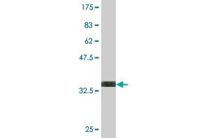 Western Blot detection against Immunogen (35. (DLX6 antibody  (AA 71-160))