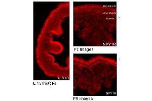 Immunohistochemistry (IHC) image for anti-Neuropeptide Y Receptor Y1 (NPY1R) (Middle Region) antibody (ABIN2777014)