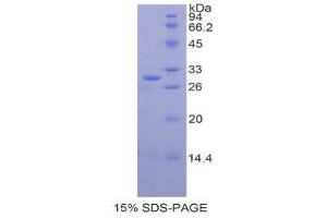 SDS-PAGE (SDS) image for Cathepsin C (CTSC) (AA 231-463) protein (His tag) (ABIN2120769)