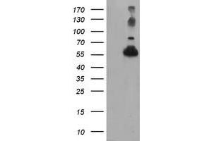 Western Blotting (WB) image for anti-Tubulin, alpha-Like 3 (TUBAL3) (AA 150-446) antibody (ABIN1490954)