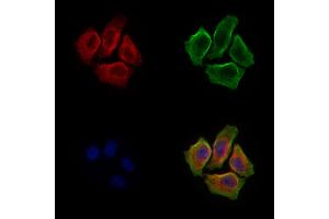 ABIN6260382 and ABIN6279246 staining Hela cells by IF/ICC.