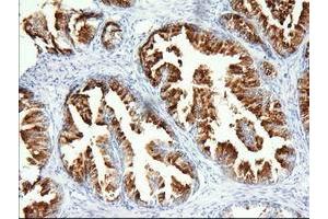 Immunohistochemical staining of paraffin-embedded Human prostate tissue using anti-PANK2 mouse monoclonal antibody. (PANK2 antibody)