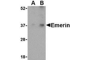 Western blot analysis of Emerin in human skeletal muscle tissue lysate with AP30313PU-N Emerin antibody at (A) 0.