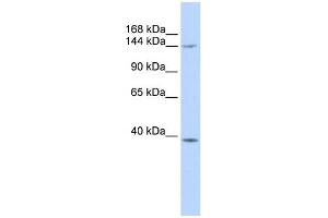 WB Suggested Anti-SMC4 Antibody Titration:  0. (SMC4 antibody  (Middle Region))