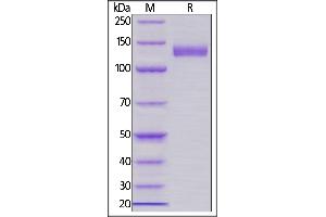 Human Siglec-2, Llama IgG2b Fc Tag, low endotoxin on  under reducing (R) condition.