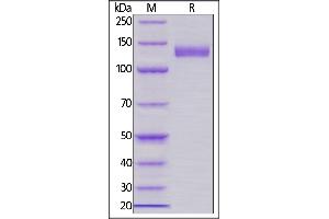 Human Siglec-2, Llama IgG2b Fc Tag, low endotoxin on  under reducing (R) condition. (CD22 Protein (AA 20-687) (Fc Tag))