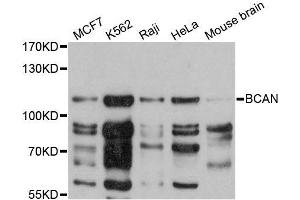 Western blot analysis of extracts of various cell lines, using BCAN antibody (ABIN5996731) at 1:3000 dilution. (BCAN antibody)