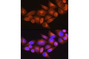 Immunofluorescence analysis of HeLa cells using WFS1 Rabbit pAb (ABIN3022419, ABIN3022420, ABIN1513689, ABIN1514834 and ABIN6218806) at dilution of 1:100 (40x lens). (WFS1 antibody  (AA 1-285))