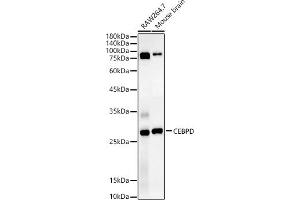 Western blot analysis of extracts of various cell lines, using CEBPD antibody (ABIN7266160) at 1:1340 dilution. (CEBPD antibody  (AA 1-269))