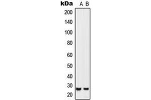 Western blot analysis of SIX6 expression in Jurkat (A), NIH3T3 (B) whole cell lysates. (SIX Homeobox 6 antibody  (Center))