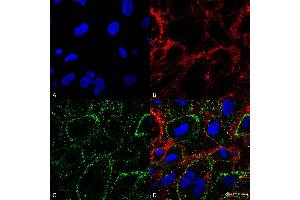 Immunocytochemistry/Immunofluorescence analysis on non-permeabilized HCT116 cells using Mouse Anti-HSP70 Monoclonal Antibody, Clone 1H11: FITC conjugate  showing cell membrane staining.