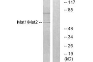 Western blot analysis of extracts from HeLa cells, treated with UV 15', using Mst1/2 (Ab-183) Antibody. (MST1/MST2 (AA 149-198) antibody)