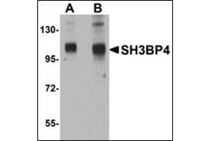 Western blot analysis of SH3BP4 in rat lung tissue lysate with this product at (A) 1 and (B) 2 μg/ml.