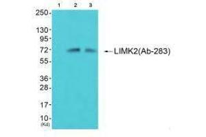 Western blot analysis of extracts from 293 cells (Lane 2) and cos-7 cells (Lane 3), using LIMK2 (Ab-283) antiobdy. (LIMK2 antibody  (Ser283))