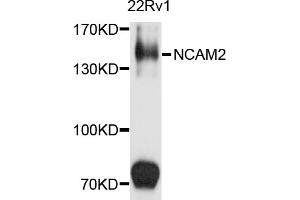 Western blot analysis of extracts of 22Rv1 cells, using NCAM2 antibody (ABIN5972146) at 1/1000 dilution. (NCAM2 antibody)