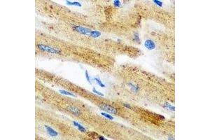 Immunohistochemical analysis of GPAM staining in mouse heart formalin fixed paraffin embedded tissue section.