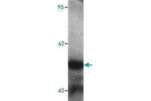 Western blot analysis of human kidney tissue lysate with TTYH2 polyclonal antibody  at 1 ug/mL.