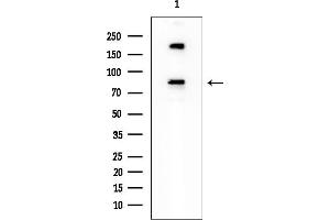 anti-3-Hydroxy-3-Methylglutaryl-CoA Reductase (HMGCR) (N-Term) antibody