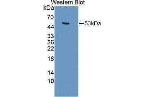 Detection of Recombinant KRT25, Mouse using Polyclonal Antibody to Keratin 25 (KRT25) (Keratin 25 antibody  (AA 1-446))