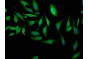 Immunofluorescence staining of Hela cells with ABIN7169088 at 1:100, counter-stained with DAPI. (NEK1 antibody  (AA 626-809))