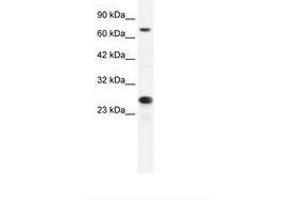 Image no. 2 for anti-Minichromosome Maintenance Complex Component 6 (MCM6) (C-Term) antibody (ABIN202926) (MCM6 antibody  (C-Term))