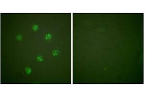 Immunofluorescence analysis of COS7 cells, using Ki67antibody. (Ki-67 antibody  (C-Term))