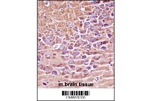Mouse Prkaca/Prkacb Antibody immunohistochemistry analysis in formalin fixed and paraffin embedded mouse brain tissue followed by peroxidase conjugation of the secondary antibody and DAB staining. (PRKACA/PRKACB antibody  (C-Term))