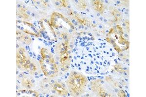 Immunohistochemistry of paraffin-embedded Mouse kidney using MOK Polyclonal Antibody at dilution of 1:100 (40x lens). (MOK antibody)