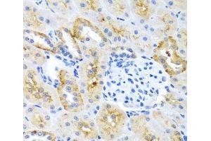 Immunohistochemistry of paraffin-embedded Mouse kidney using MOK Polyclonal Antibody at dilution of 1:100 (40x lens).