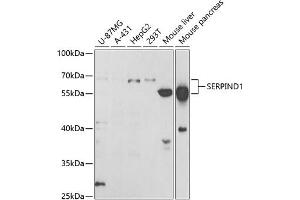 Western blot analysis of extracts of various cell lines, using SERPIND1 antibody (ABIN6131316, ABIN6147598, ABIN6147599 and ABIN6221548) at 1:1000 dilution. (SERPIND1 antibody  (AA 20-290))