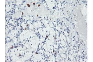 Image no. 2 for anti-Ubiquitin Specific Peptidase 36 (USP36) (AA 589-972) antibody (ABIN1491604) (USP36 antibody  (AA 589-972))