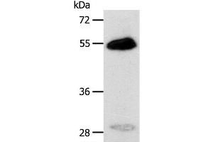 Western Blot analysis of Human liver cancer tissue using CA14 Polyclonal Antibody at dilution of 1:400 (CA14 antibody)
