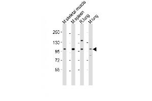 All lanes : Anti-Fgfr4 Antibody (Center) at 1:2000 dilution Lane 1: mouse skeletal muscle lysates Lane 2: mouse spleen lysates Lane 3: rat lung lysates Lane 4: mouse lung lysates Lysates/proteins at 20 μg per lane. (FGFR4 antibody  (AA 448-482))