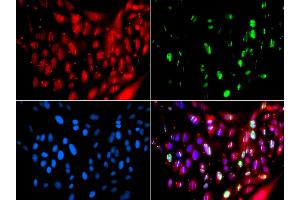 Immunofluorescence analysis of GFP-RNF168 transgenic U2OS cells using UIMC1 antibody (ABIN6128891, ABIN6149915, ABIN6149916 and ABIN6223082). (UIMC1 antibody  (AA 1-230))