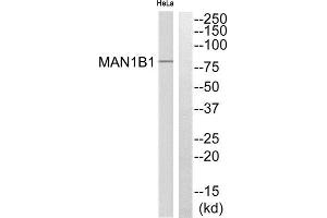 Western Blotting (WB) image for anti-Mannosidase, Alpha, Class 1B, Member 1 (MAN1B1) (Internal Region) antibody (ABIN1851304)