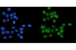 IF analysis of PARP using anti-PARP antibody (ABIN7602276). (PARP1 antibody  (AA 670-858))