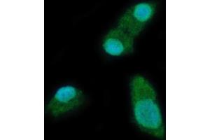 IF analysis of YTHDC2 using anti-YTHDC2 antibody (ABIN7599661). (YTHDC2 antibody  (AA 105-1231))