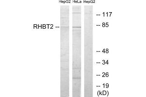 Western blot analysis of extracts from HepG2 cells and HeLa cells, using RHBT2 antibody. (RHOBTB2 antibody  (N-Term))