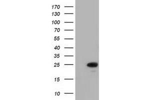 Western Blotting (WB) image for anti-MOB Kinase Activator 3B (MOB3B) antibody (ABIN1499537)