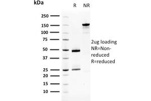 SDS-PAGE Analysis Purified SqCC Antigen 1 Mouse Monoclonal Antibody (CPTC-SERPINB3-2). (SERPINB3 antibody)