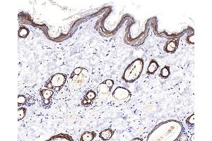 Immunohistochemistry analysis of paraffin-embedded rat skin using CK-17 Polyclonal Antibody at dilution of 1:400. (KRT17 antibody)
