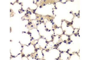 Immunohistochemistry of paraffin-embedded Mouse lung using CXXC1 Polyclonal Antibody at dilution of 1:200 (40x lens).