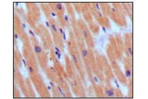 Immunohistochemical analysis of paraffin-embedded human normal myocardium, showing cytoplasmic localization using BNP3 mouse mAb with DAB staining.