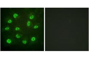 Immunofluorescence analysis of HuvEc cells, using Estrogen Receptor-beta (Phospho-Ser105) Antibody. (ESR2 antibody  (pSer105))
