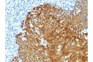 Immunohistochemical staining (Formalin-fixed paraffin-embedded sections) of human skin with Pan Cytokeratin polyclonal antibody . (Cytokeratin 7 antibody)
