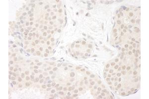 Immunohistochemistry (IHC) image for anti-DEAD (Asp-Glu-Ala-Asp) Box Polypeptide 23 (DDX23) (AA 1-50) antibody (ABIN7453861)