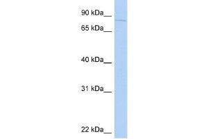 KIF2C antibody used at 1 ug/ml to detect target protein. (KIF2C antibody  (N-Term))